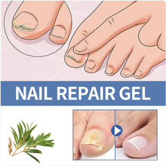 Nail Fungus Repair Gel